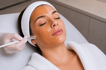 Peeling Químico